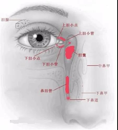 泪点塞治疗干眼，干眼的另一种治疗方法？