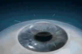 0dc8c8ef3f160450d4d3f57b54f3398b_1-21062G1425Q49.gif