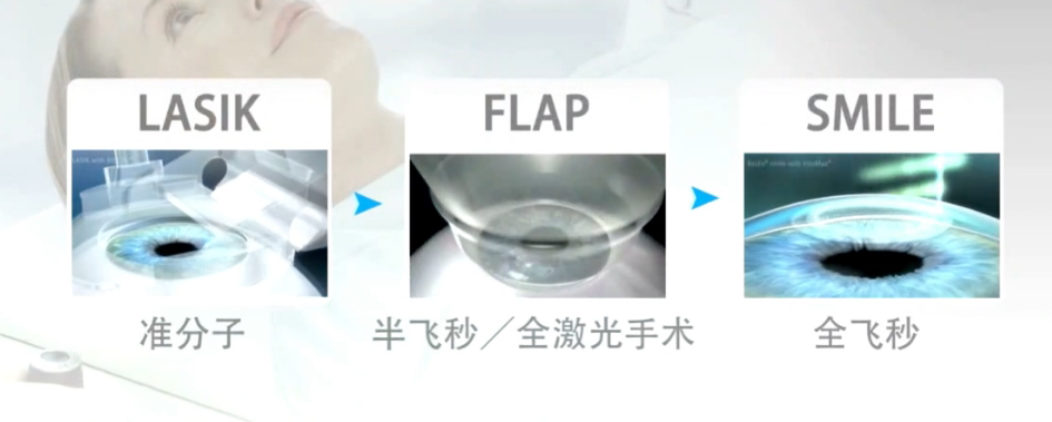 近视眼矫正手术费用是多少？参军前多久做近视手术？