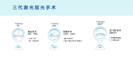 近视眼手术最佳年龄和度数是多少？大概需要多少钱？