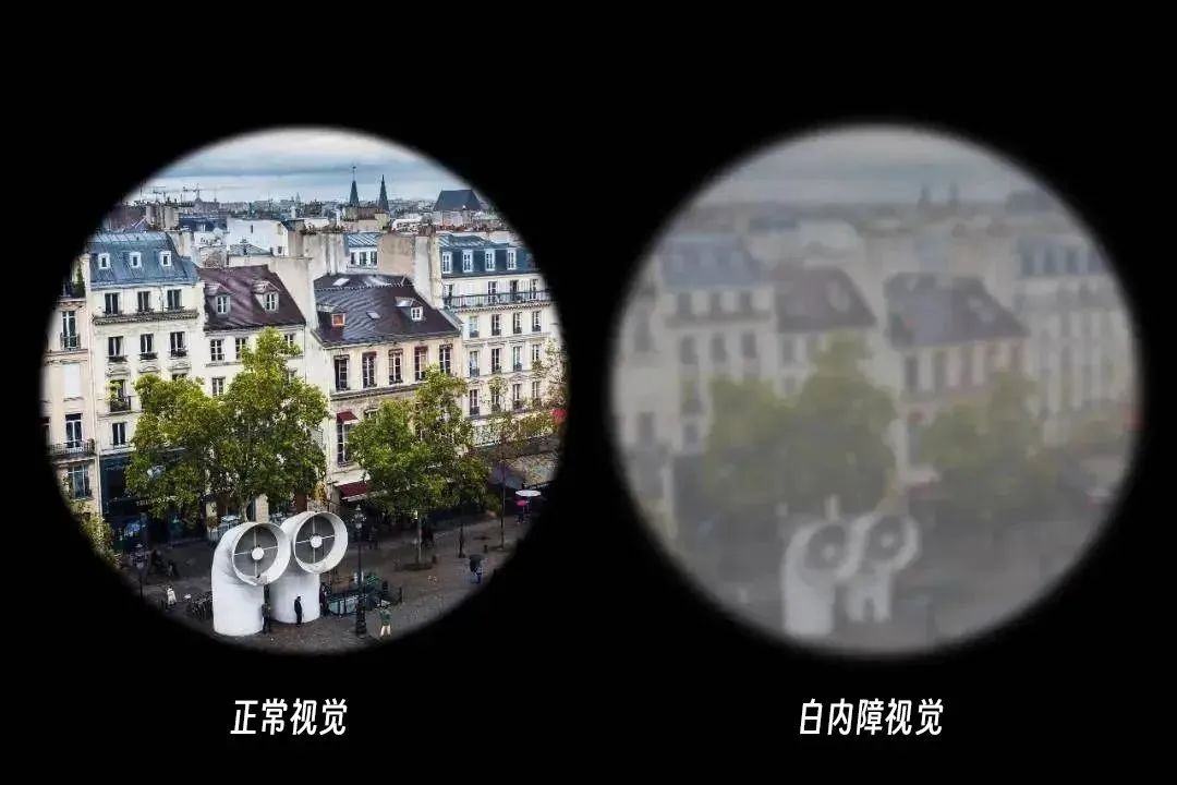 家有老人的请注意，这几项眼检查必不可少！