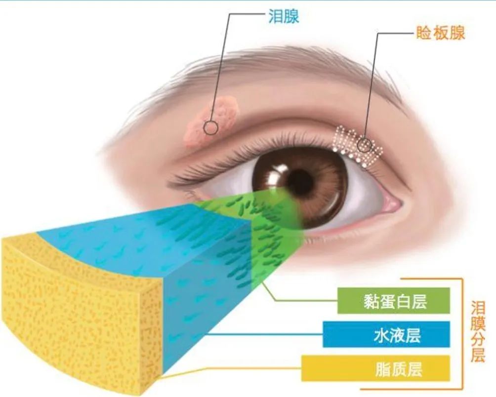 眼内挑出大量虫子是真还是假？睑板腺可以按摩吗？