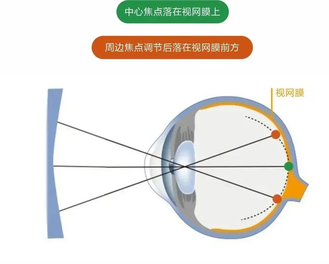 青少年防控近视眼镜有效果吗？有哪些品牌比较好？