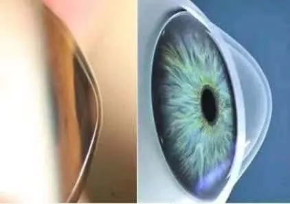 008.png