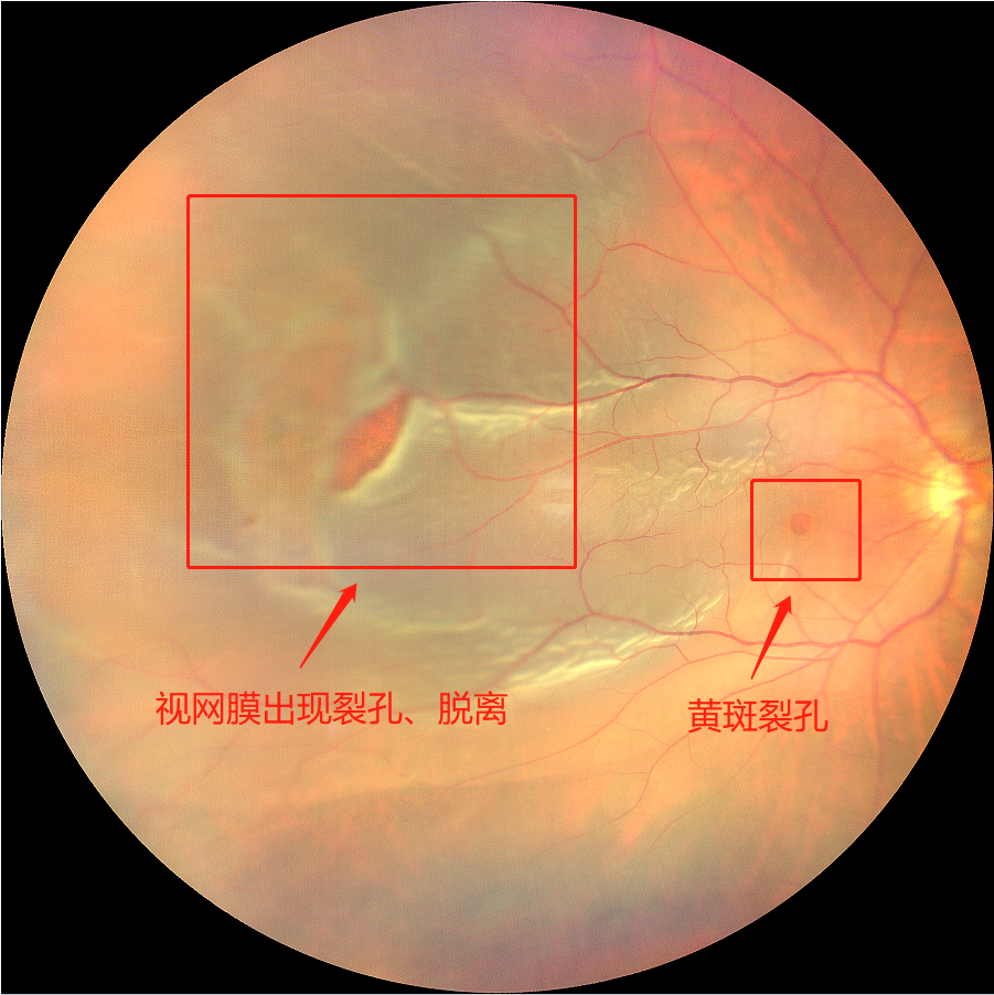 1750645723741438.png 640 (12).png
