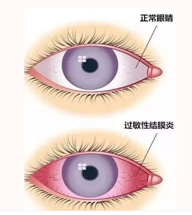 微信截图_20250624170945.png