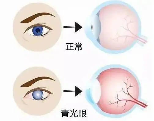 a38436d88b205e52d5787299f0cc144.png