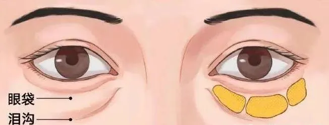 0bd1161c7477b2afaa2a1a34dd7e11b.png