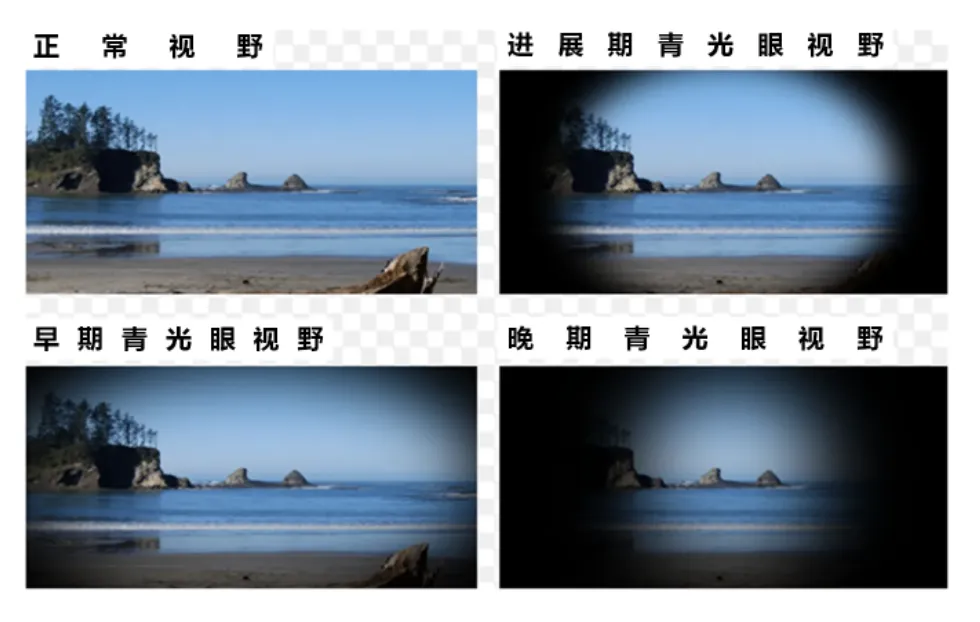 68f07817b957e3f7e758d4449b1d7f3.png
