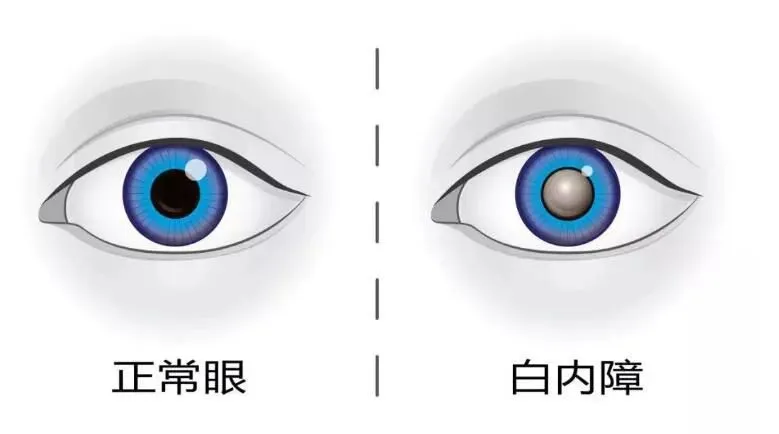 3842ea560b08207f92f6e39b9ac8183.png