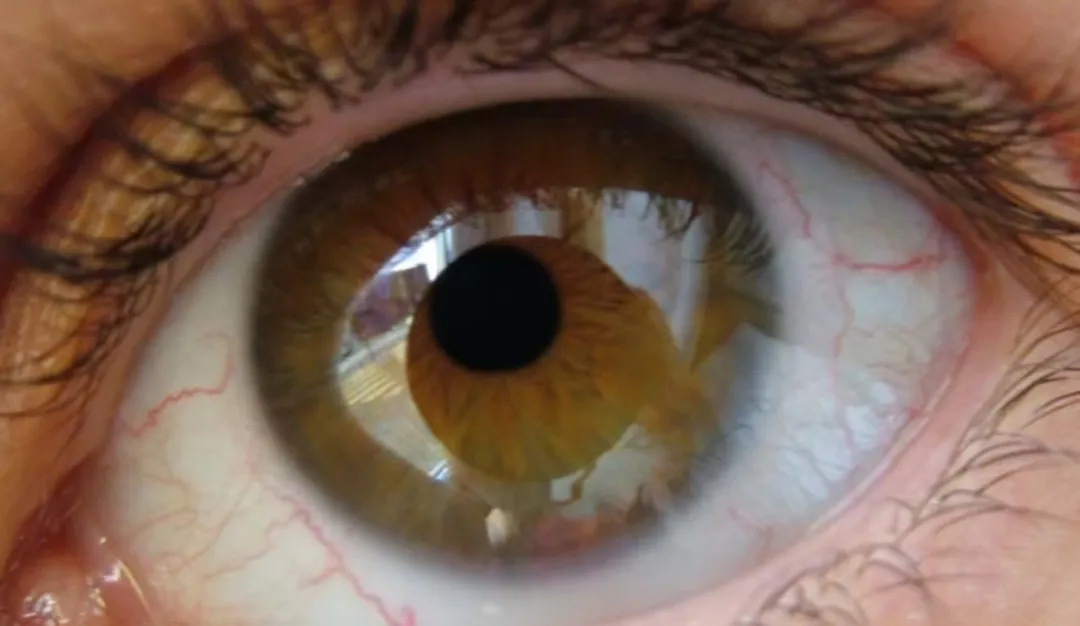 2a14b52a4125a83881d27790e28b0fd.png