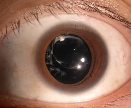 4c0eb70ad4c7d05d5f44ef97d76931e.png