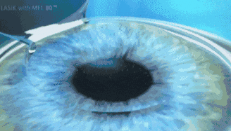 3.gif