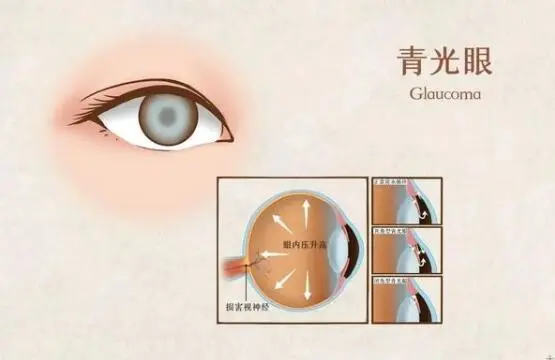 图片245.png