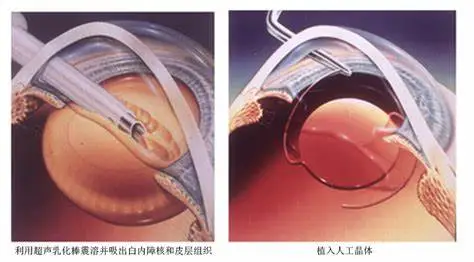 图片336.png