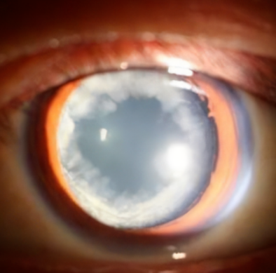 e5336a8b44165c551d7ab32a5092b5c.png
