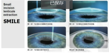 微信截图_20250701153550.png