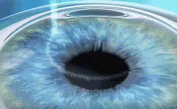 3DD9977E-0EE8-4A0A-9F75-3D5648E44124_4_5005_c.jpeg