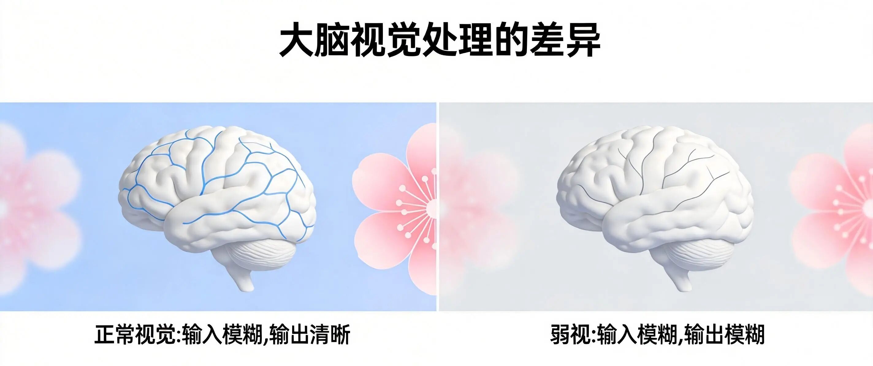 同样的300度，为什么她看1.0，你只能看0.6？配镜单上不会写的5个秘密!