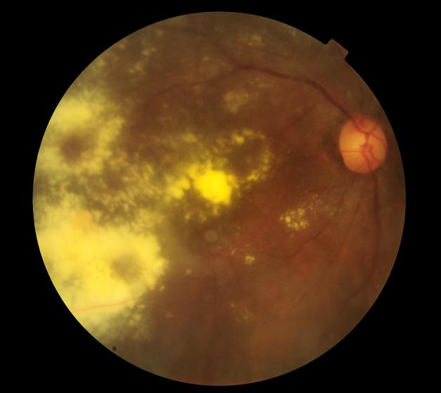 医生总让你做OCT，到底在查什么？一文读懂“眼睛断层扫描”的秘密！