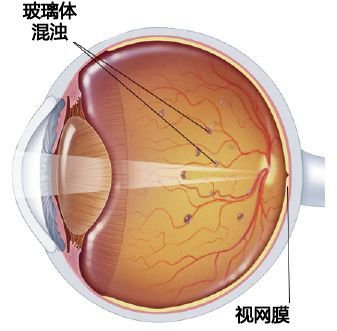 医生总让你做OCT，到底在查什么？一文读懂“眼睛断层扫描”的秘密！
