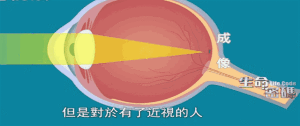 为了让高度近视的脚步慢下来，我选择“绑紧”孩子的眼球